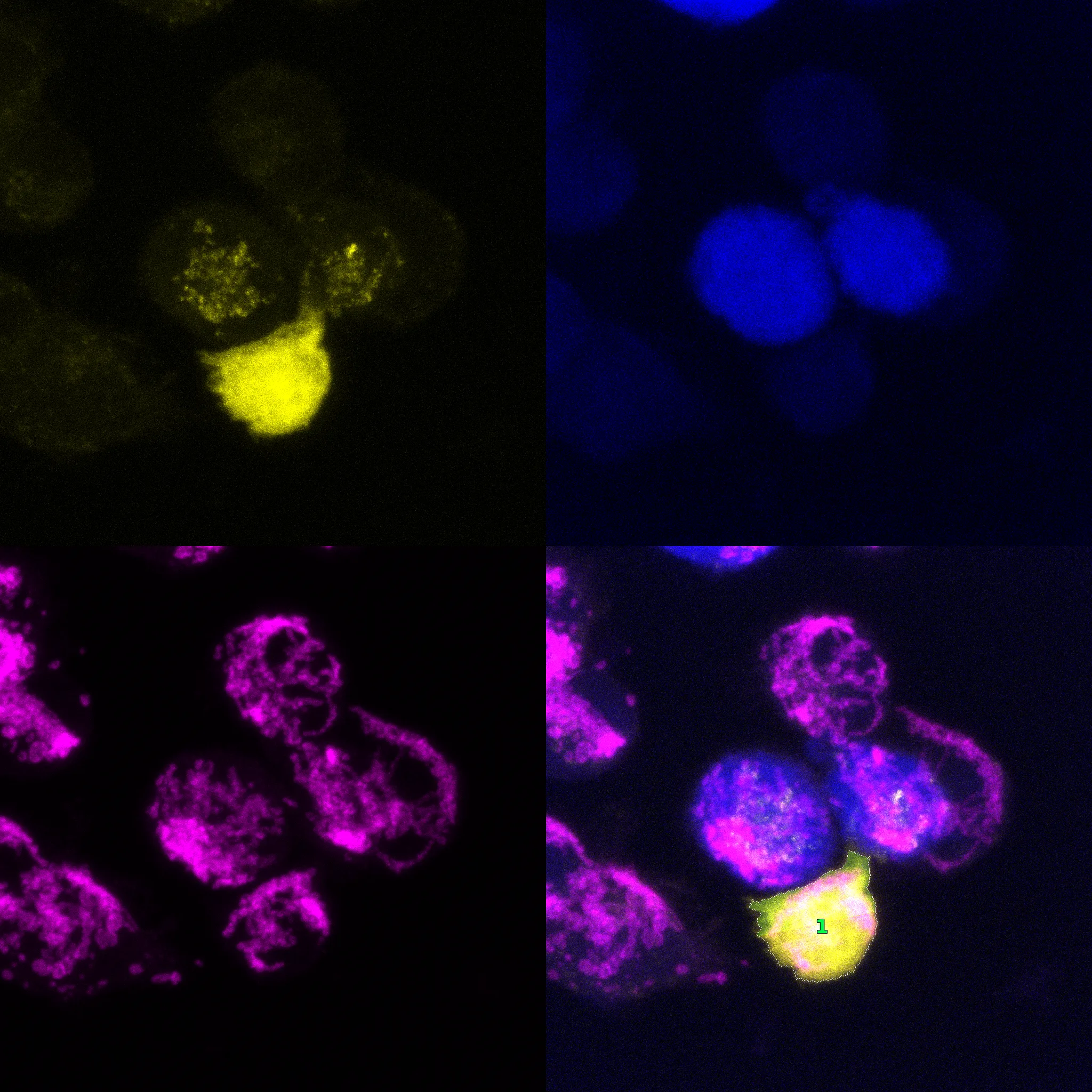 Multi-channel confocal microscopy analysis