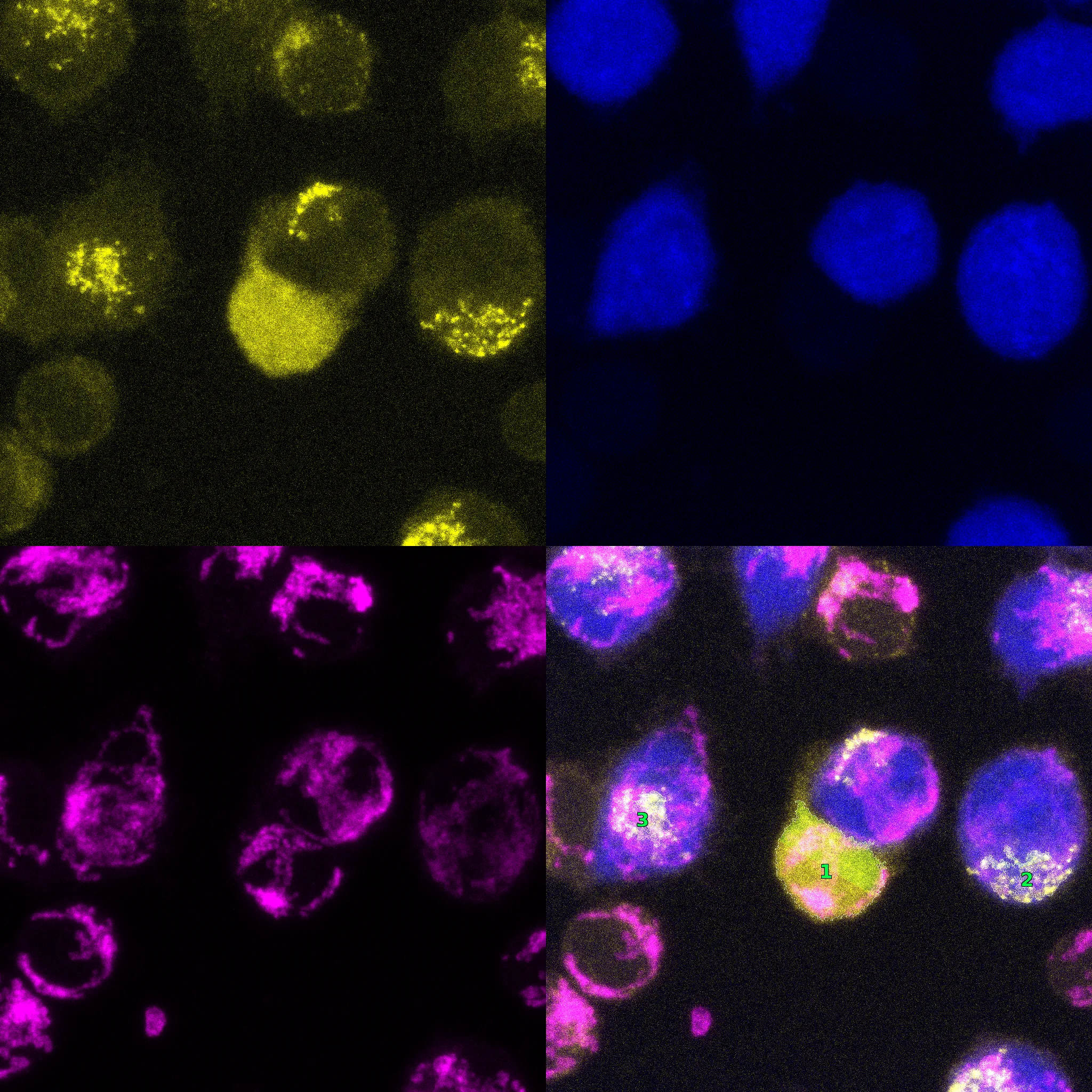 Multi-channel confocal analysis algorithm output