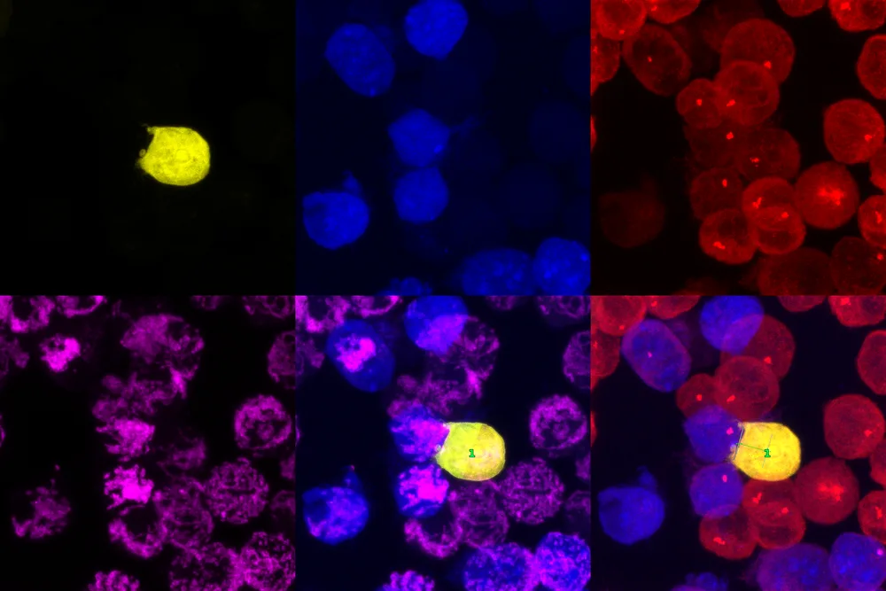 Multi-channel confocal analysis algorithm output