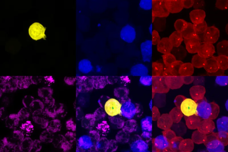 Multi-channel confocal microscopy analysis